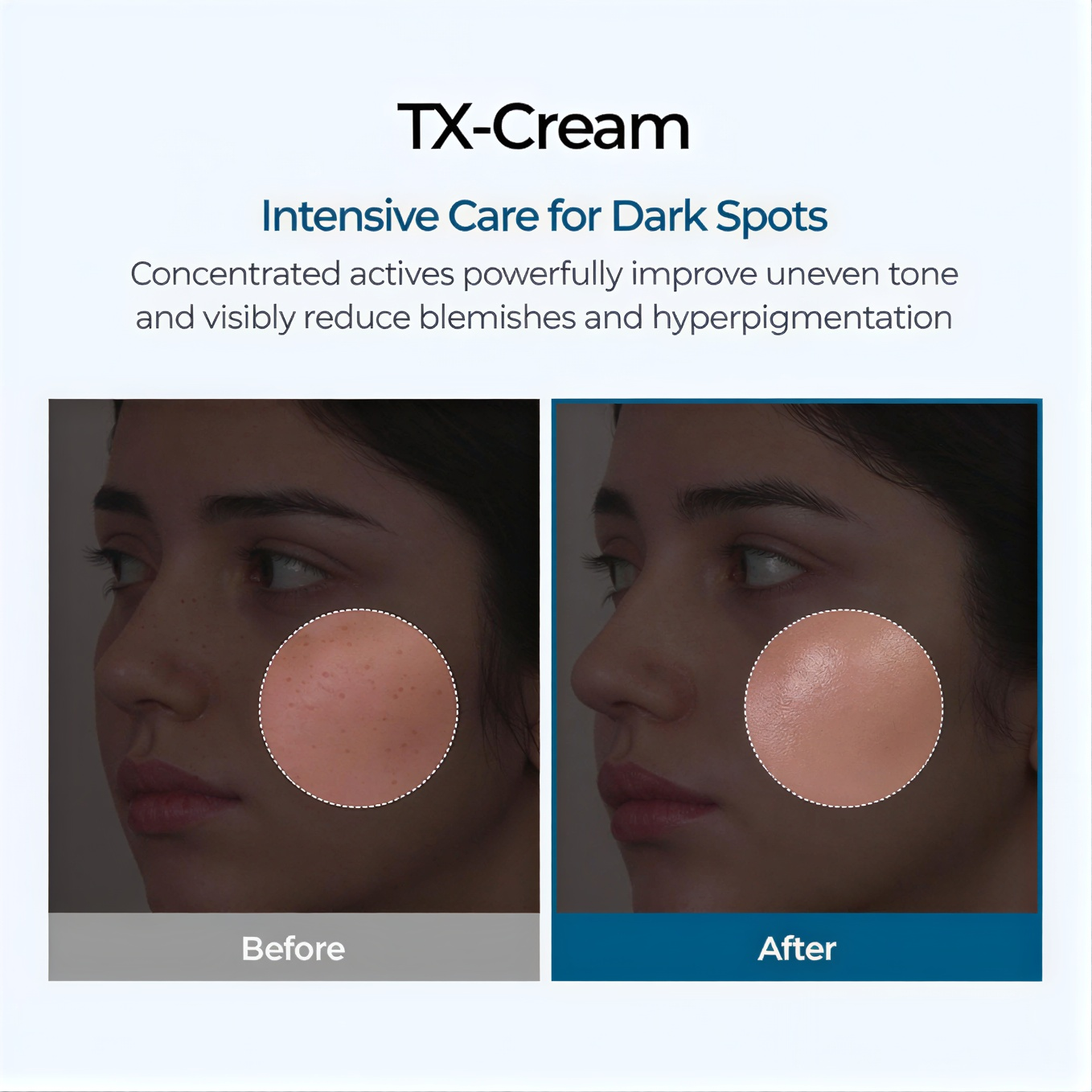 Tranexamic Acid + Niacinamide Brightening Cream.